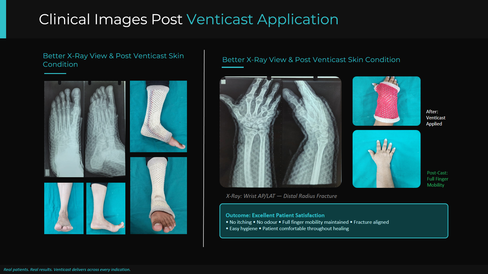 Venticast Conference Promotion Presentation Design